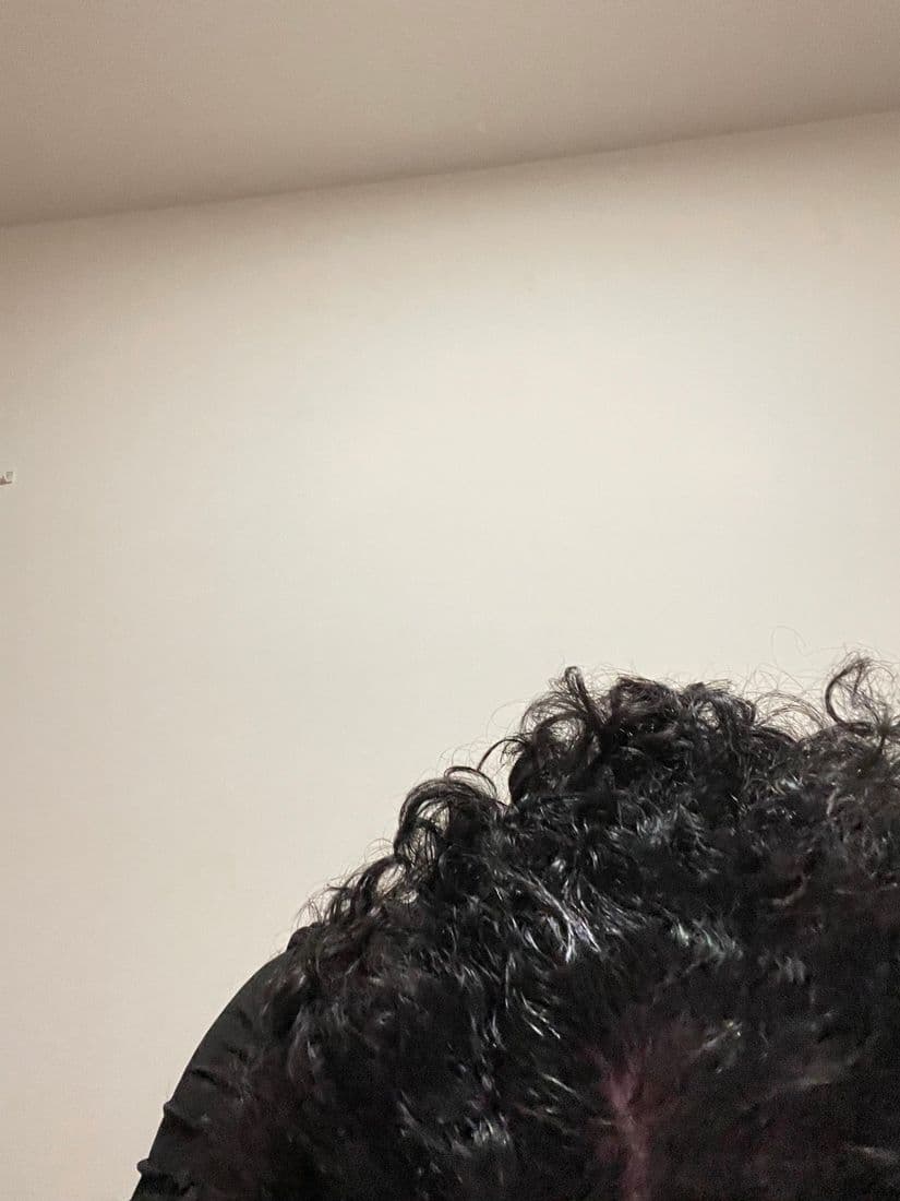 Crown of the head parted with scalp visible