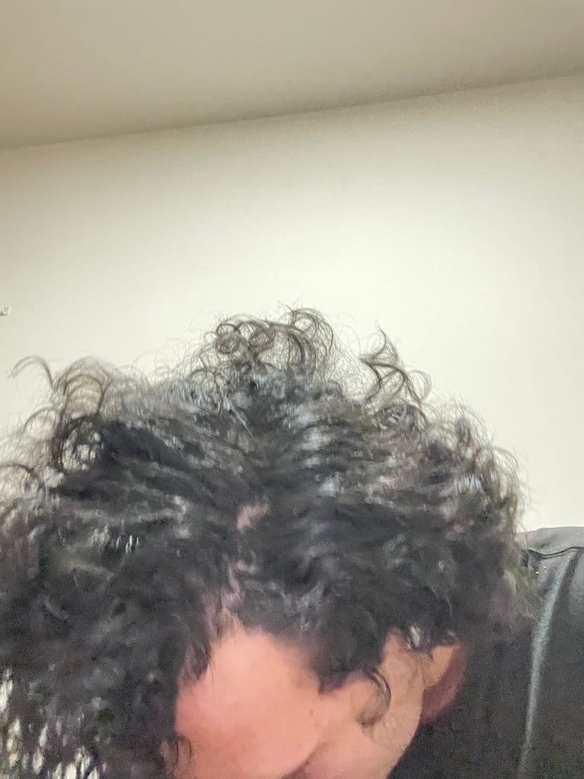 Very close view of the scalp where hair is thinning