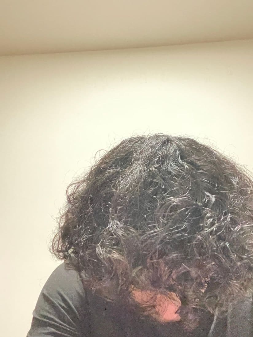 Side view of the hair down after the serum routine