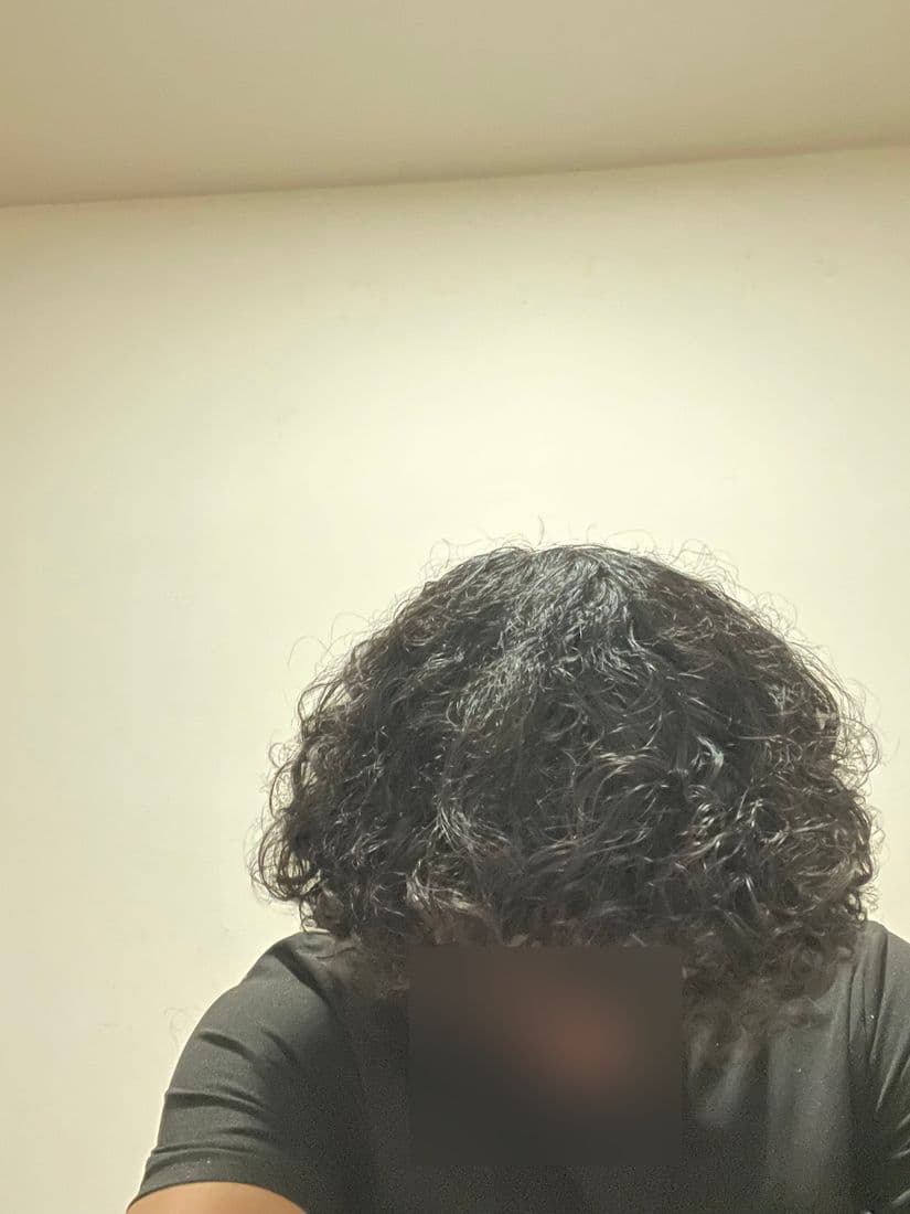 Applying serum near the hairline (face blurred for privacy)